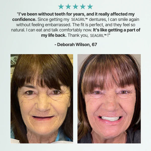 Ends Today: 70% OFF! SEAGRIL™? Custom-Fit Full Functional DenturesMake you more confident